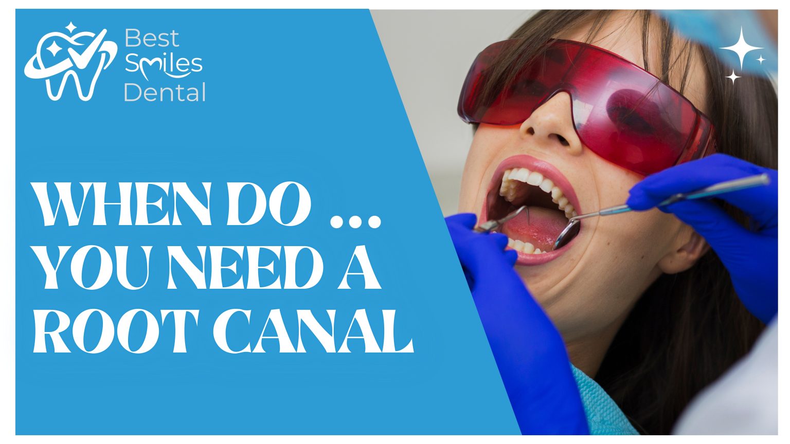 When Do You Need a Root Canal? Warning Signs You Shouldn’t Ignore