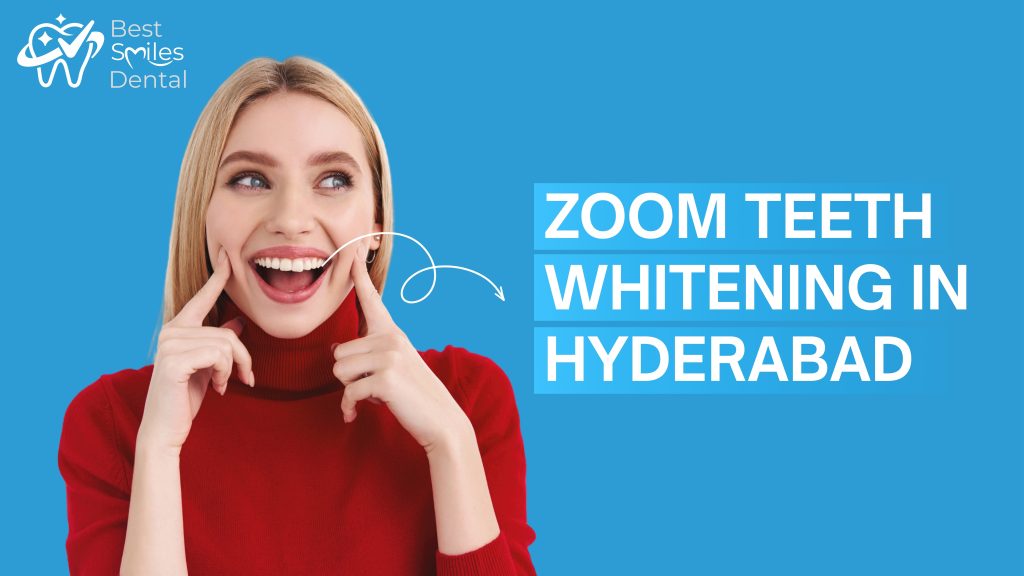 zoom teeth whitening in hyderabad