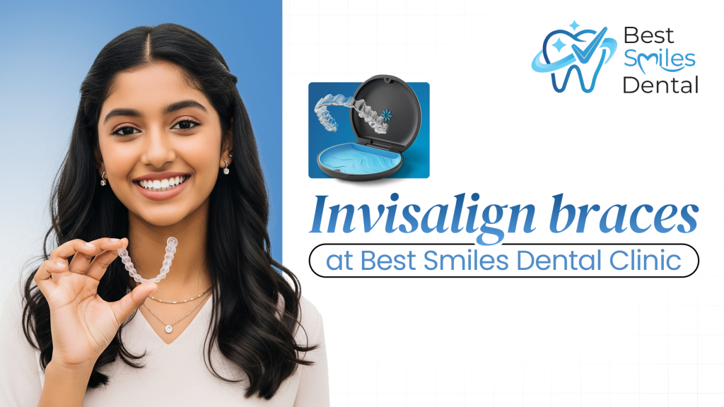 Invisalign Braces in Hyderabad