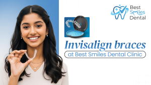 Invisalign Braces in Hyderabad