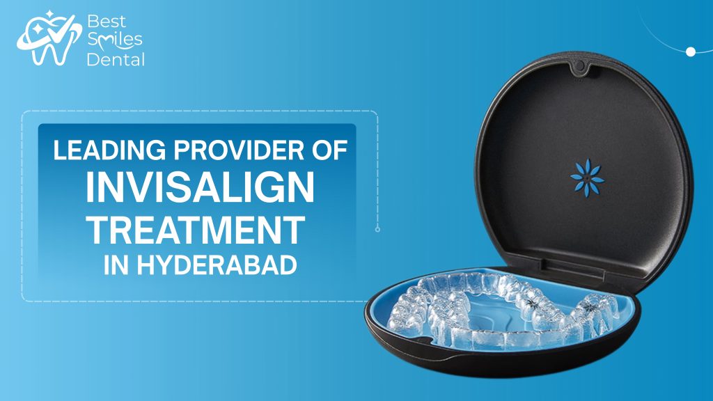 leading provider of Invisalign treatment in Hyderabad
