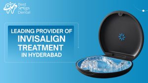 leading provider of Invisalign treatment in Hyderabad