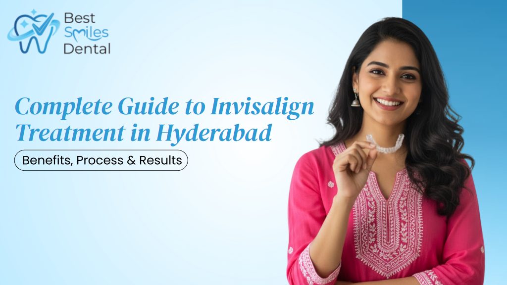 Invisalign Hyderabad