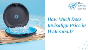 Invisalign Price in Hyderabad