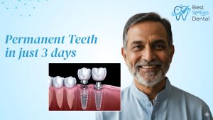 permanent teeth in just 3 days