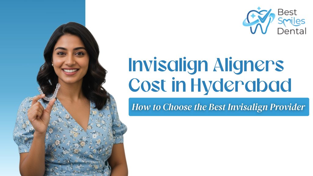 Invisalign Aligners Cost in Hyderabad