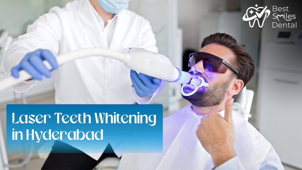 laser teeth whitening in hyderabad