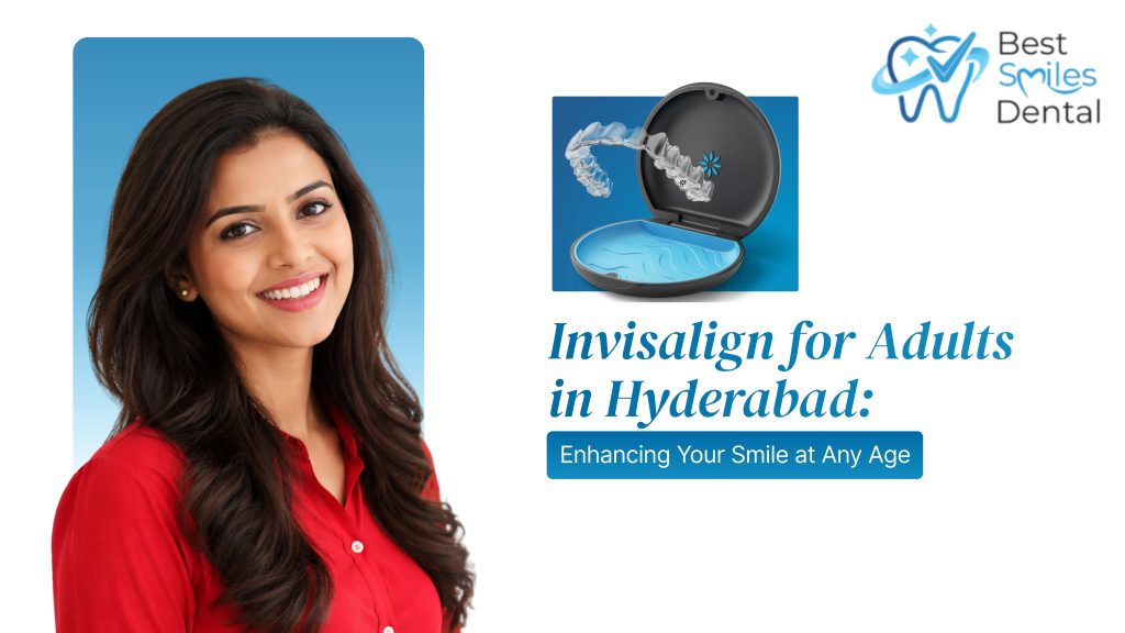 Invisalign for Adults in Hyderabad