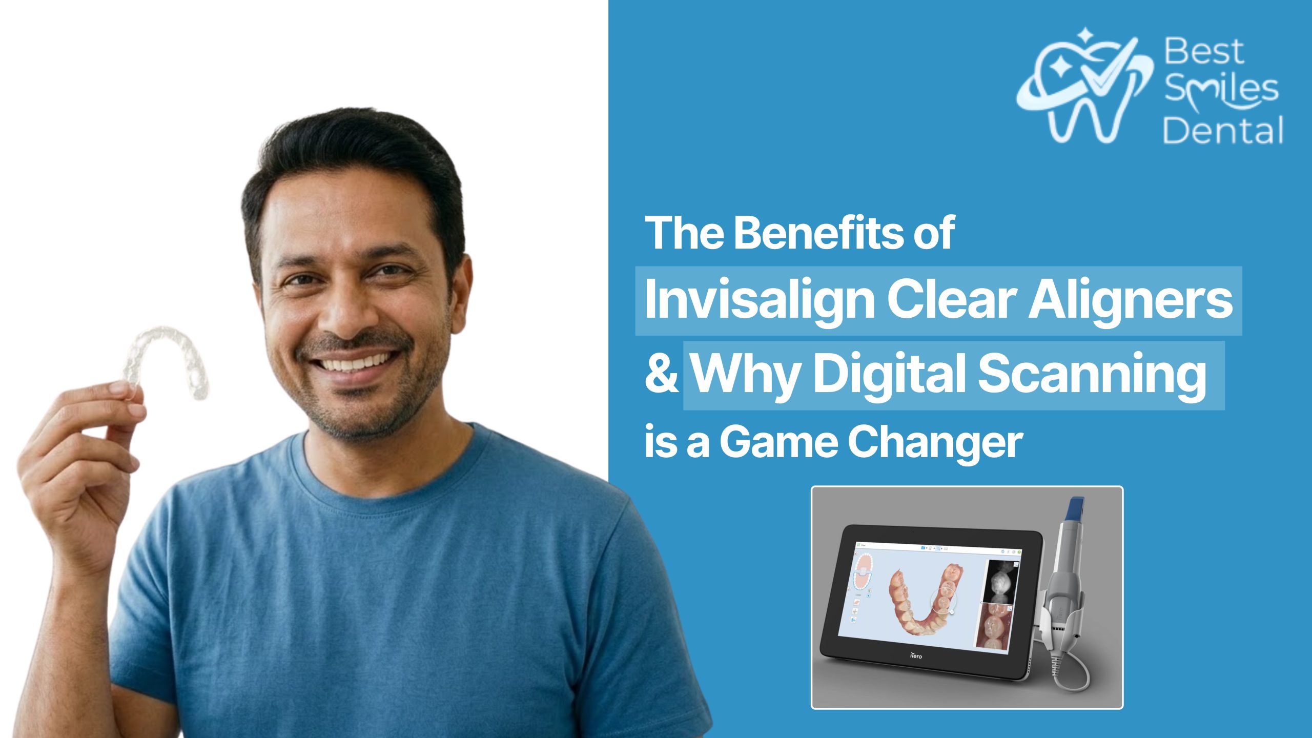 The Benefits of Invisalign Clear Aligners & Why Digital Scanning is a ...
