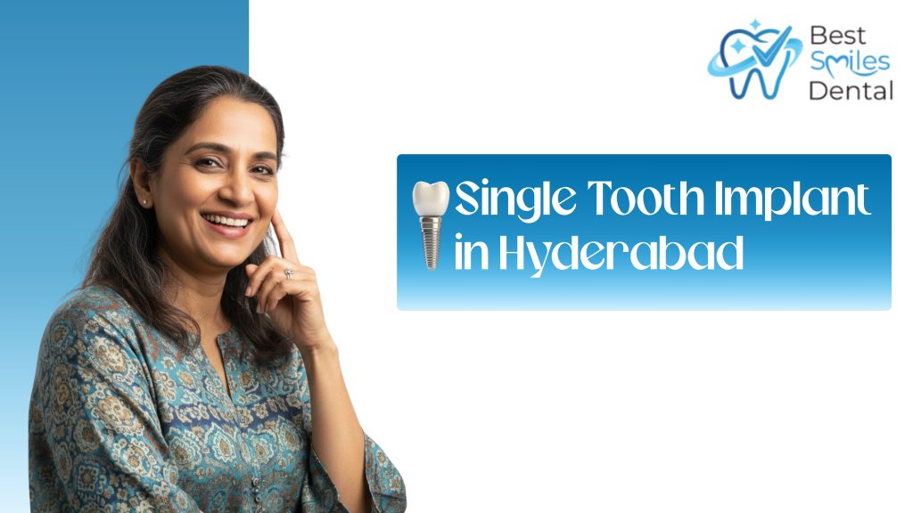 Single Tooth Implant in Hyderabad