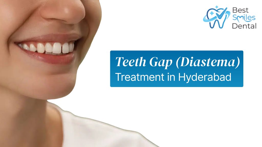 teeth gap treatment in hyderabad
