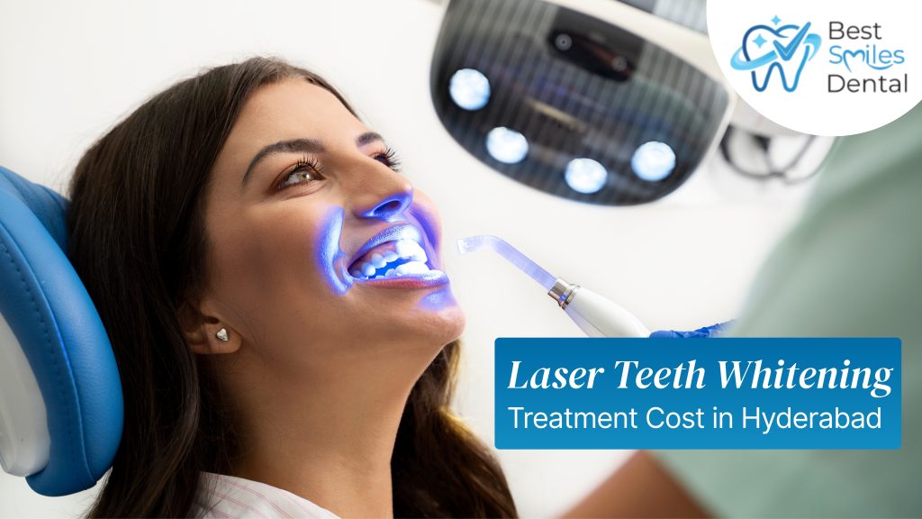 laser teeth whitening cost