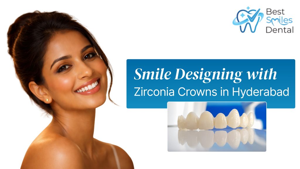 smile designing with zirconia