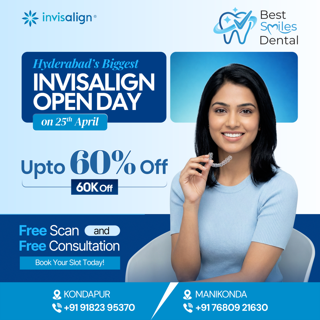 Hyderabad's Biggest Invisalign Open Day Offer - Kondapur & Manikonda