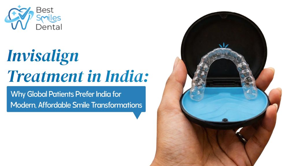 Invisalign Treatment in India