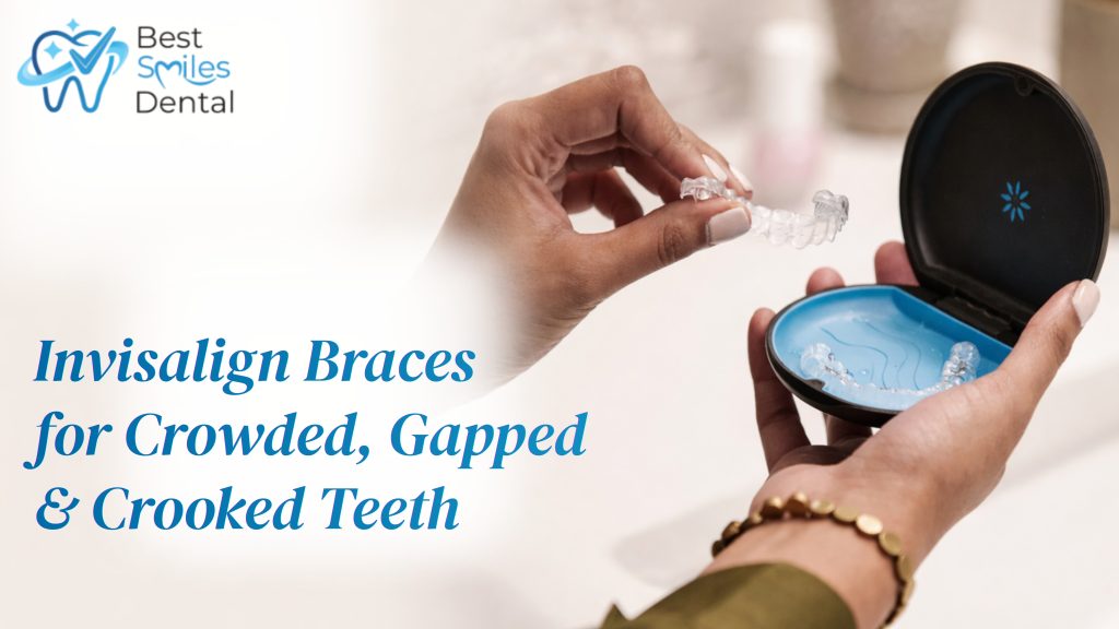 invisalign treatment for crowded teeth