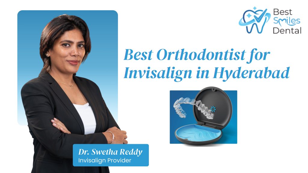 Best Invisalign Doctor in Hyderabad