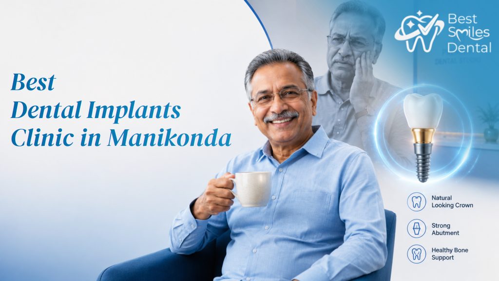 dental implants clinic in manikonda