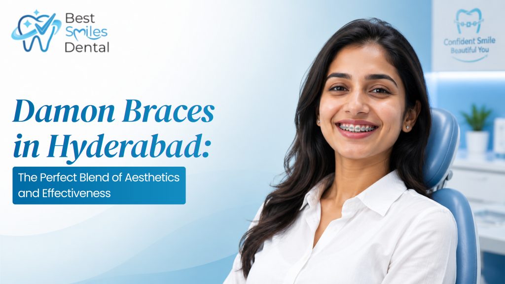 Damon Braces treatment in Hyderabad