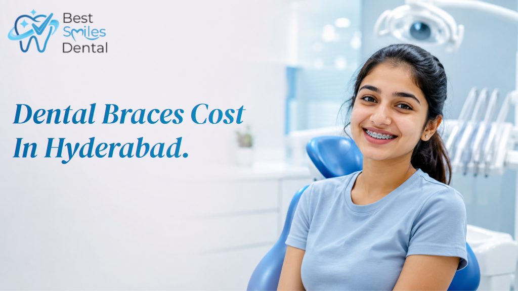 Dental Braces Cost in Hyderabad