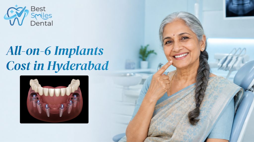 all on 6 dental implants cost in hyderabad