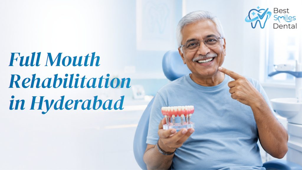 full mouth rehabilitation in hyderabad
