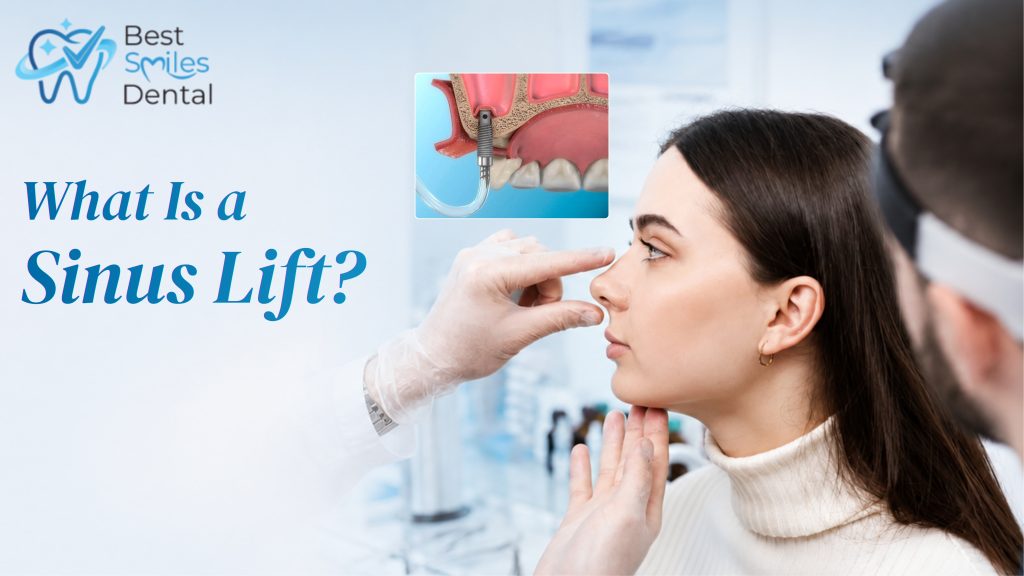 sinus lift before implants