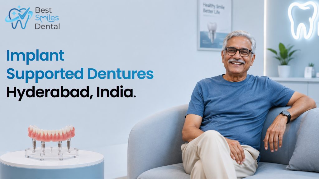 Implant Supported Dentures in Hyderabad