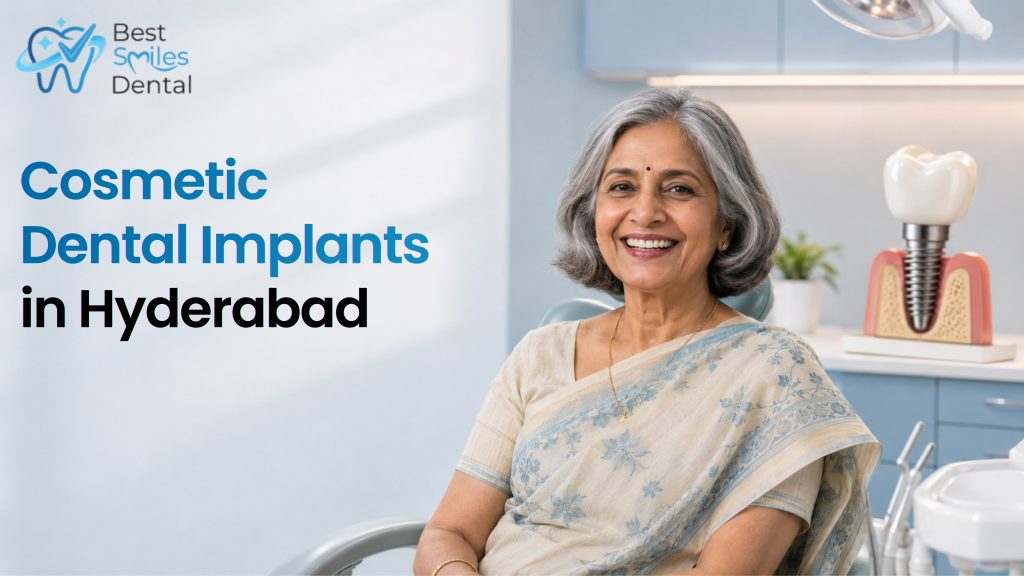 Cosmetic Dental Implants in Hyderabad