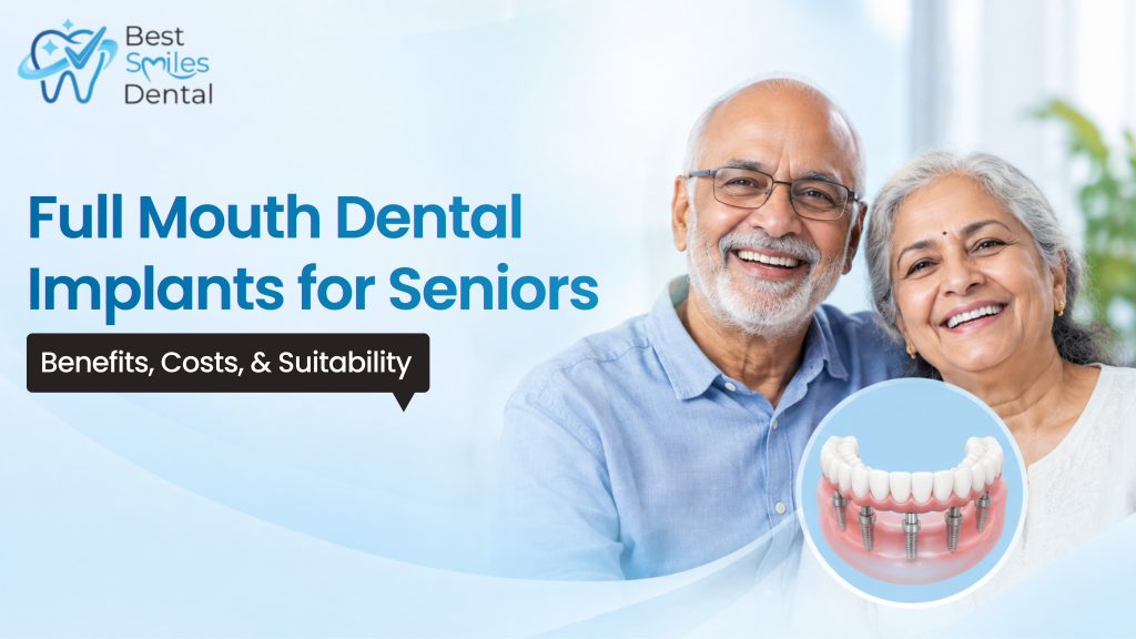 Full Mouth Dental Implants for Seniors in Hyderabad