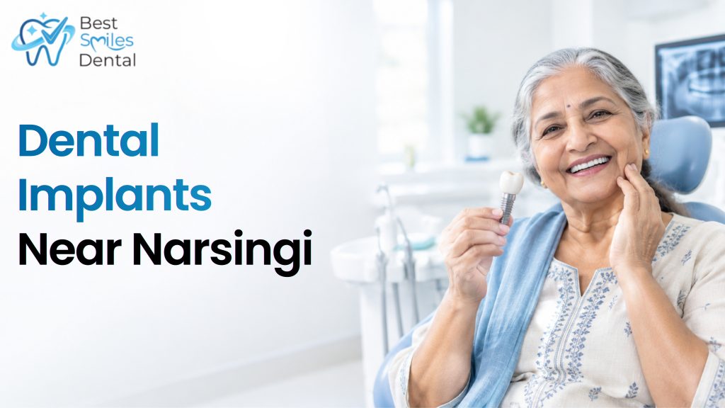 dental implants near narsingi